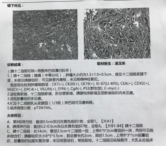 有没有人能帮忙解答一下，十二指肠腺癌中分化的预后情况